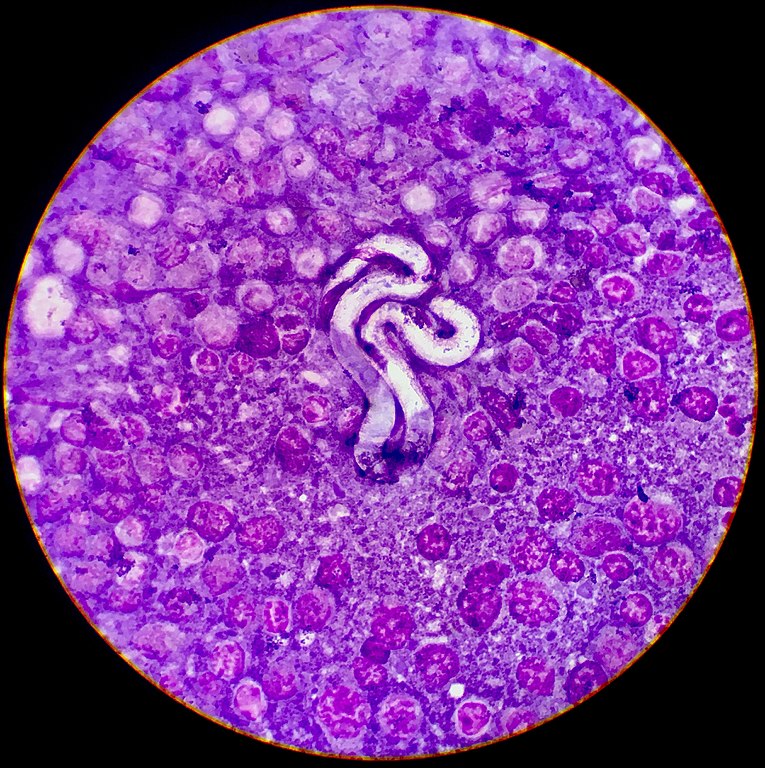 microscopic view of baby heartworm in dog